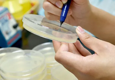 Scientist using a Sharpie to label Petri plates.